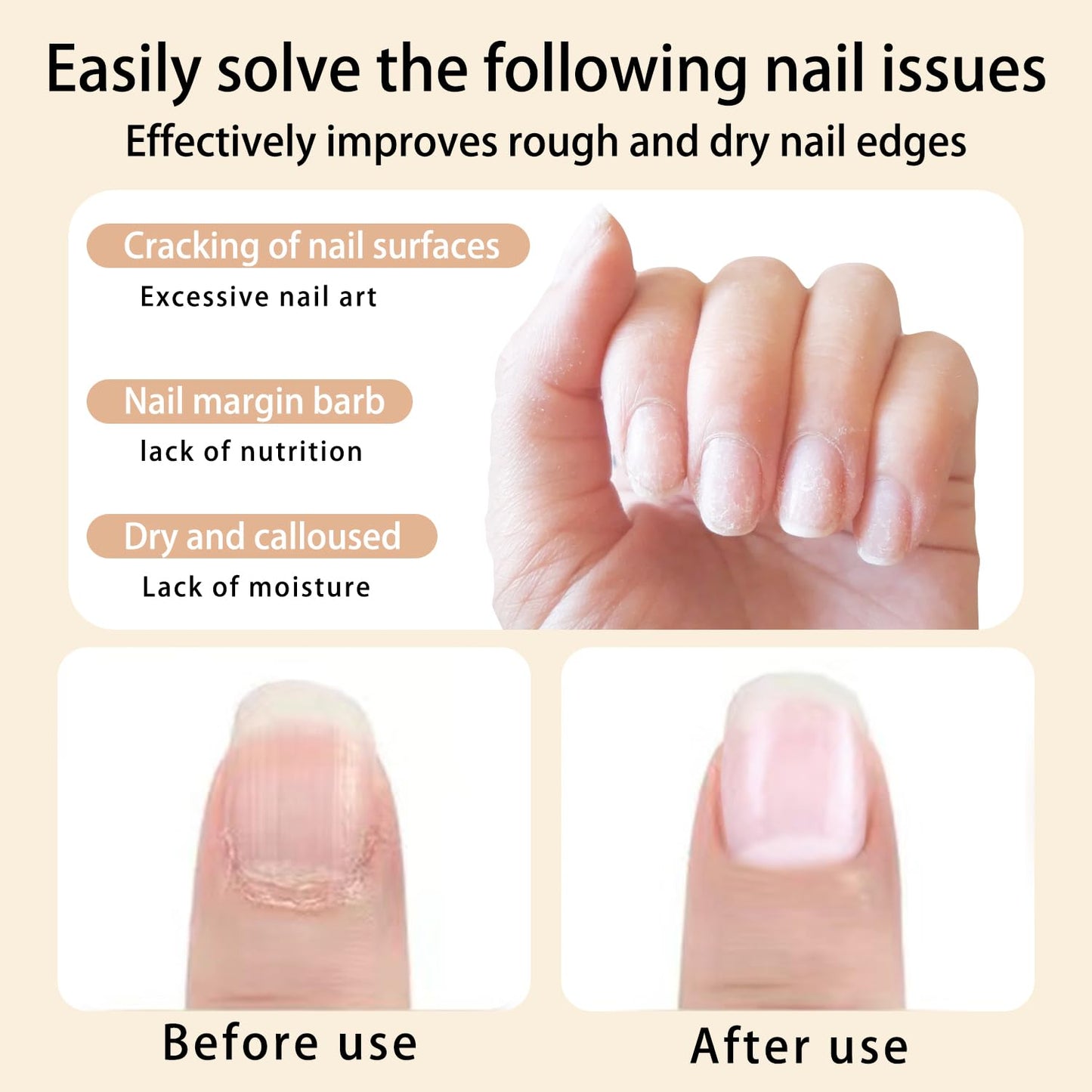 2pcs Cuticle Oil Pen Sweet Almond Nail Growth Serum and Repair Treatment Hydrating Oilfor DryCuticles and Skin CuticleBuddy Revitalize Nailswith Radiant Cosmetics' NailGrowthOil