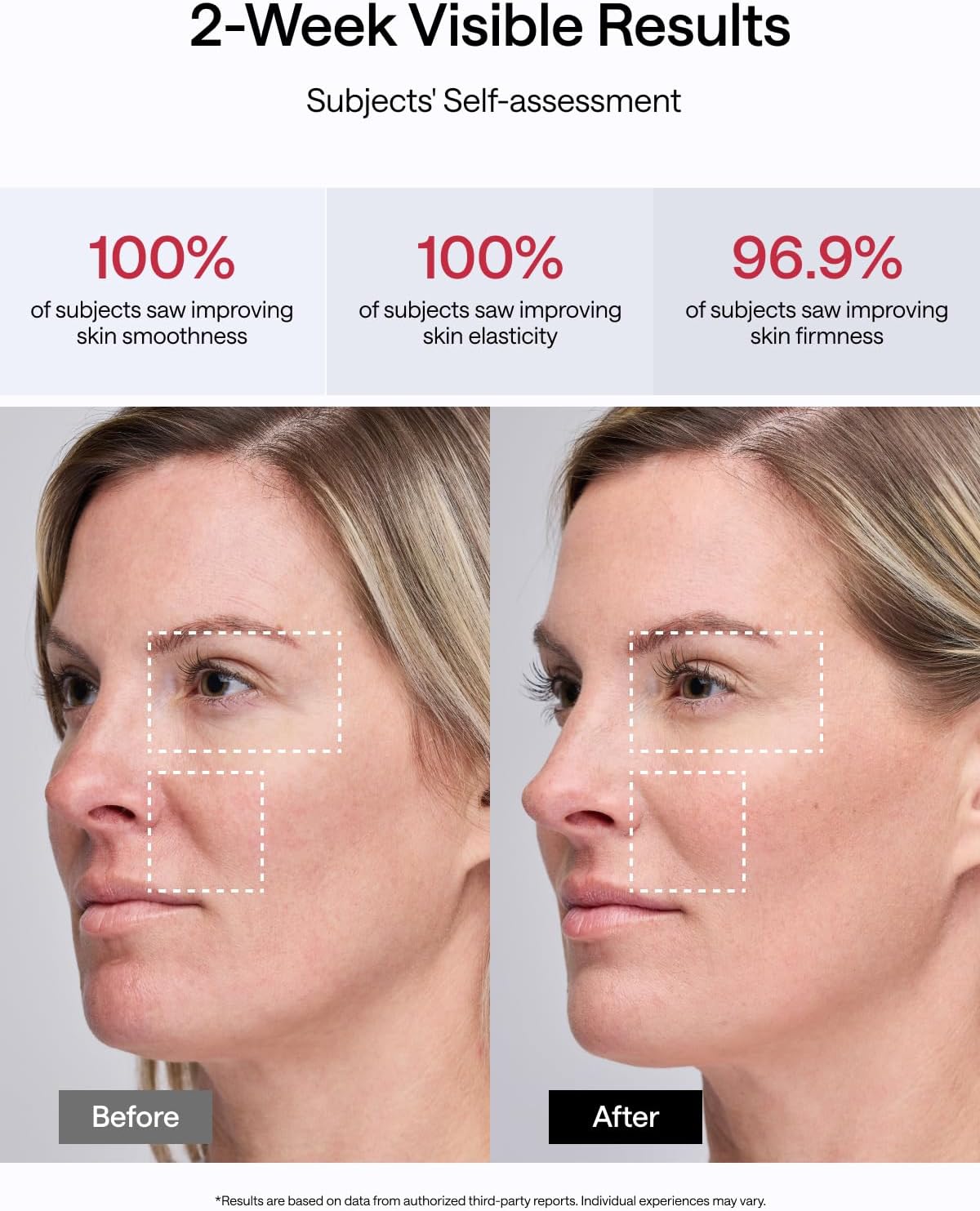 JMOON NouvelleSkin Facial Toning Device, M30U Red Light Therapy for Face, FDA-Cleared for Safer Treatment of Facial Wrinkles, 4 Modes, 5 Energy Levels for Full Face, JMOON Gel Included