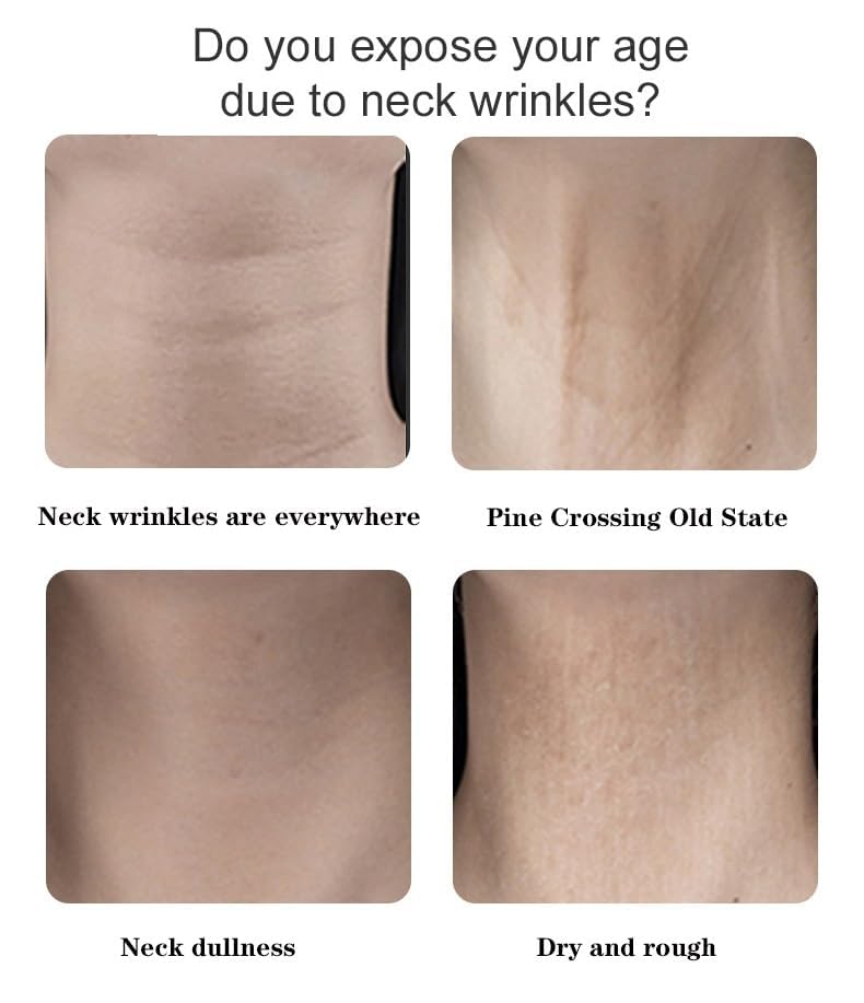 Neck Lift Tape-40 Neck Wrinkle Tape Instant Necktape Lift, Breathable Lift Strap Tightening Tapes for Necks Face Jaw Firming Neck Skin (m)