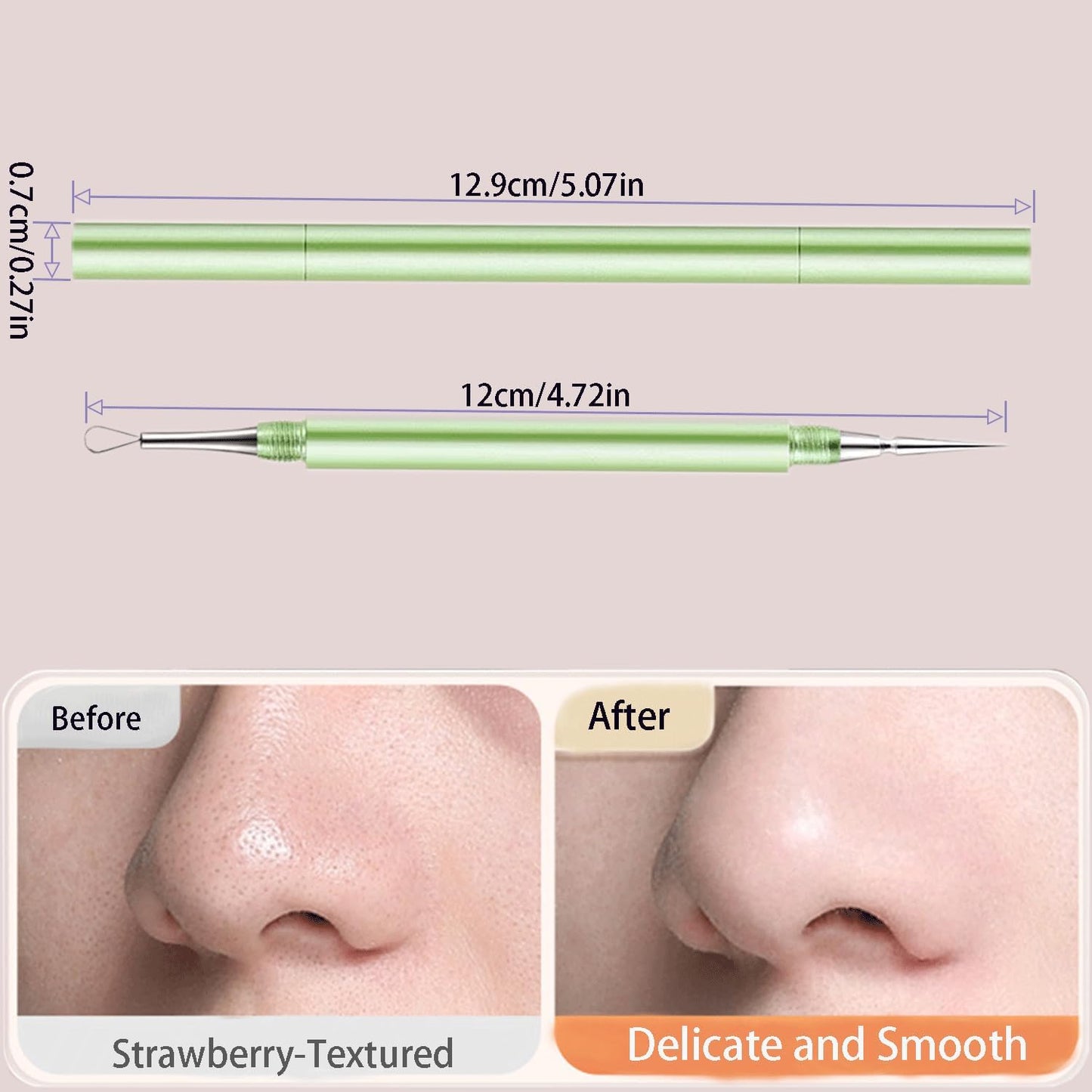 2-in-1 Professional Stainless Steel Acne Removal Needle, Whitehead & Blackhead Remover Tool, Pimples Comedone Extractor Removal Tool, Double Ended Needle with Cap Removal for Nose Face Tools(Purple)