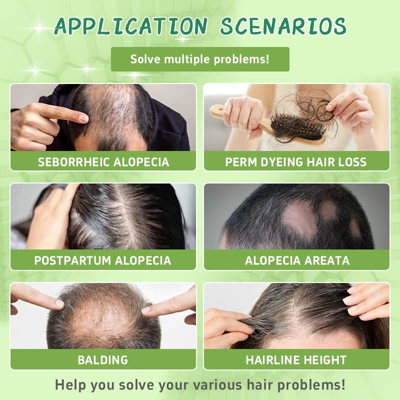 Hair Regrowth System, Advanced Hair Growth Treatment Ginseng, Eclipta Prostrata, Peppermint Oil & Ginger Root, Strengthens Roots, Thickening Serum for Men & Women