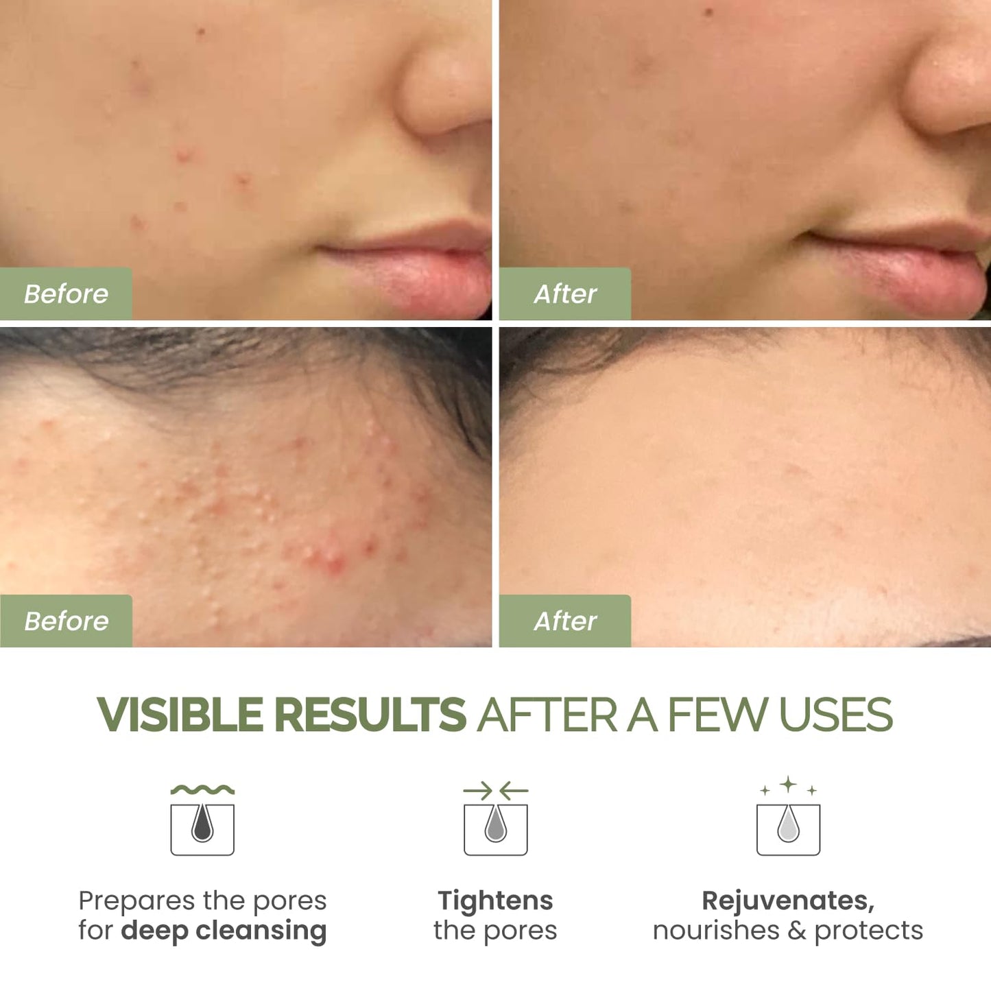 PLANTIFIQUE Korean Skincare Clay Mask – Hydrating Mud Mask with Avocado & Superfoods, Dermatologist-Tested for Face & Body – Vegan, 3.4 Oz/100ml