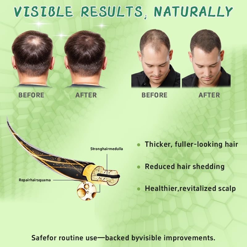 Hair Regrowth System, Advanced Hair Growth Treatment Ginseng, Eclipta Prostrata, Peppermint Oil & Ginger Root, Strengthens Roots, Thickening Serum for Men & Women