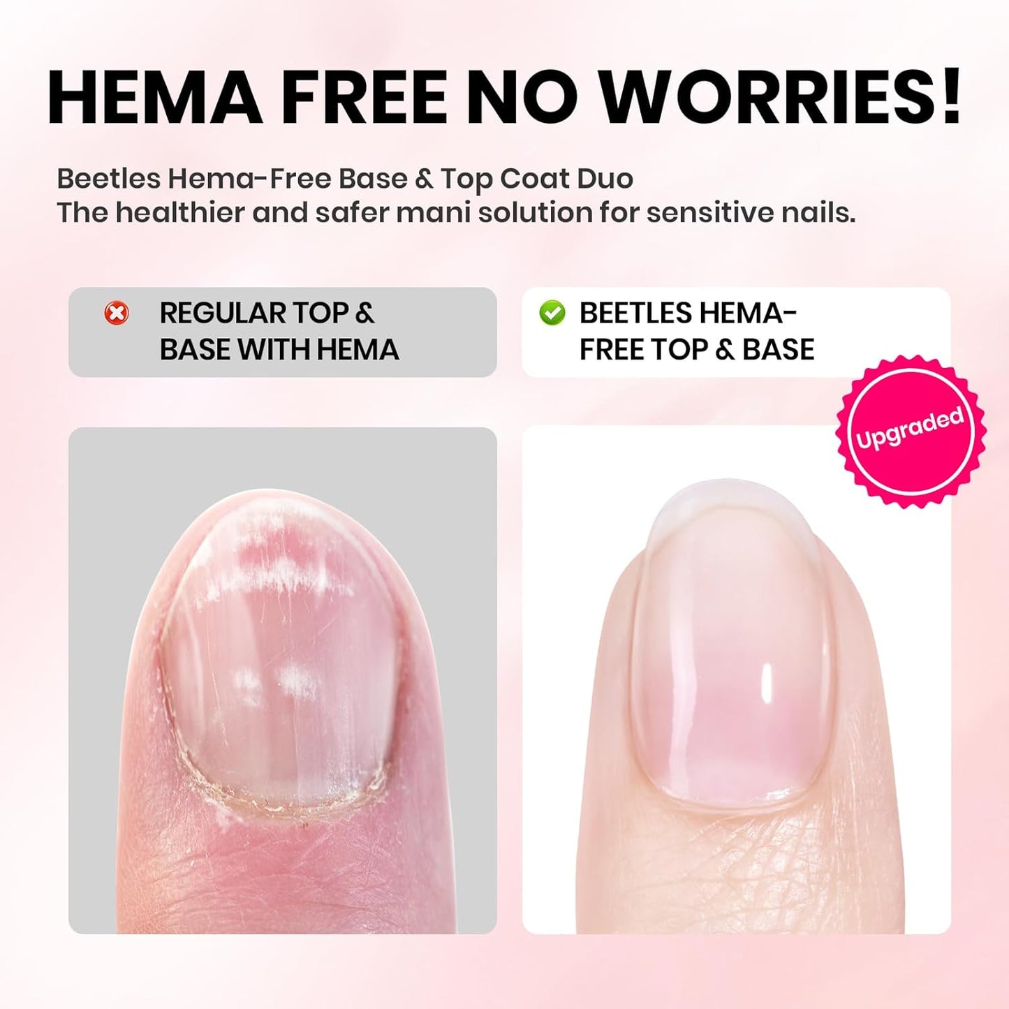 Beetles 15ml Gel Base and Top Coat Set HEMA Free, TPO Free Top Coat Gel Nail Polish & Base Clear Glossy Long Lasting No Wipe Soak Off Upgraded Safe Low-Sensitivity, No More Damaged Gifts for Women