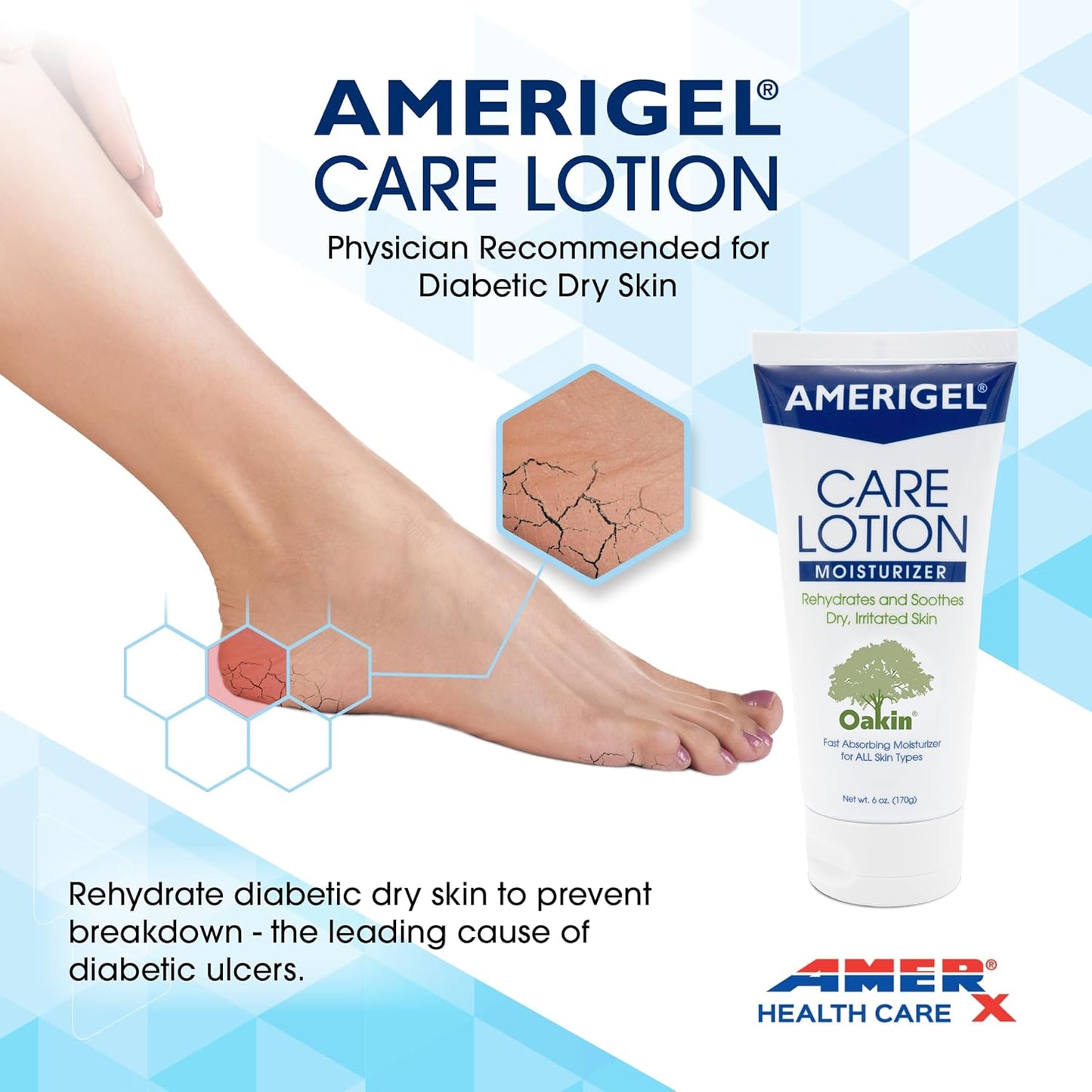AMERIGEL Care Lotion – Hypoallergenic Moisturizer - Diabetic Skin Care - Rehydrates and Soothes Dry, Irritated Skin - 16 oz.