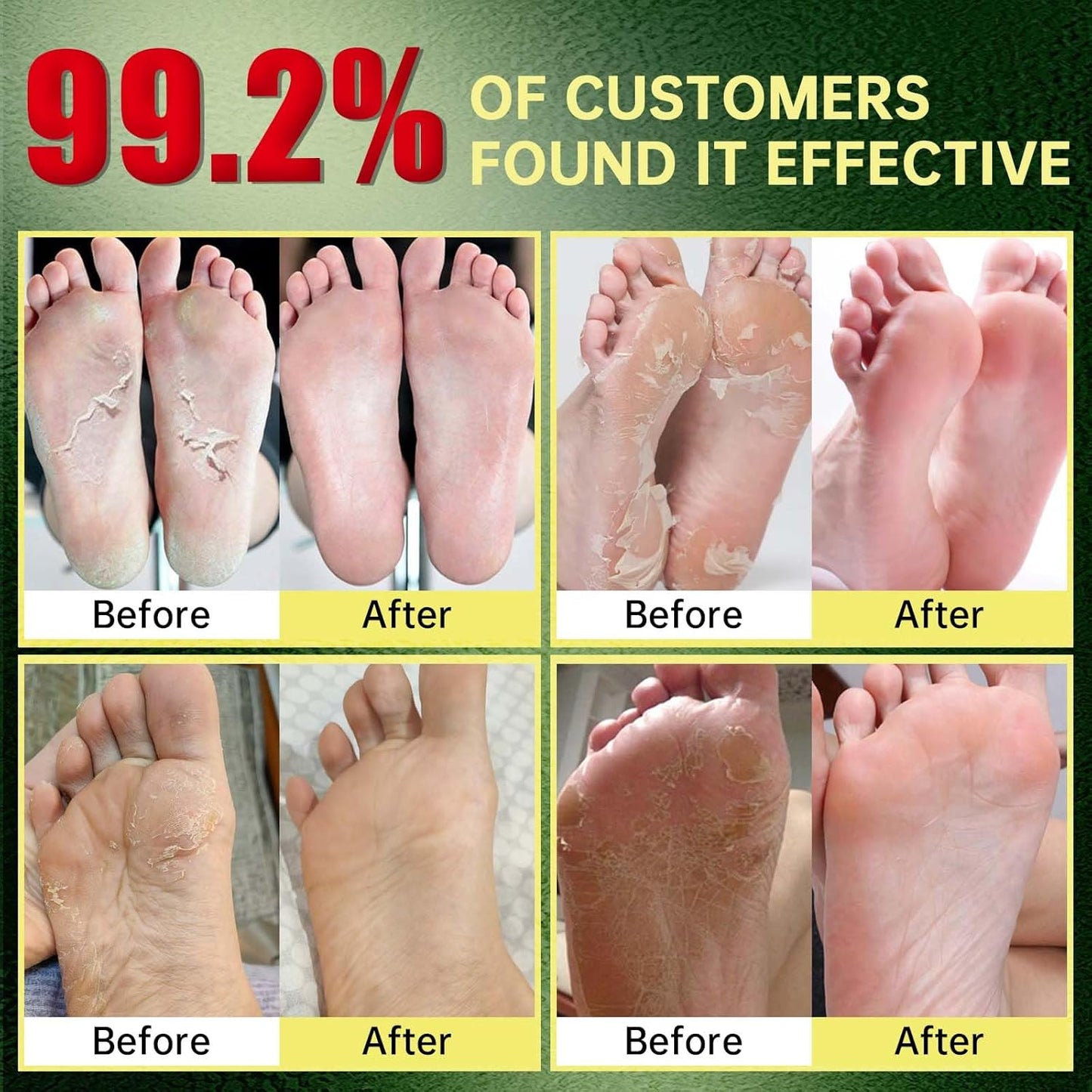 Foot Peeling Mask, Natural Exfoliating Foot Mask, Dead Skin Callus Remover Repair Heels, Hydrating Foot Care for Dry Cracked Feet (6 Pack)