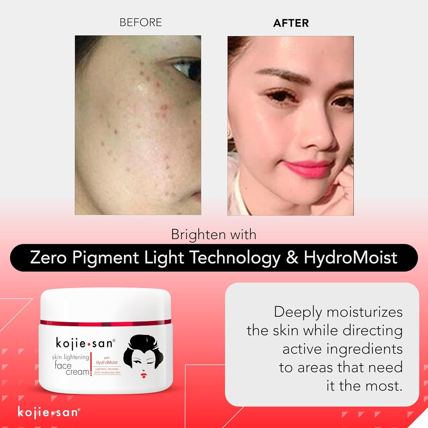 Kojie San Face & Body Complete Brightening Mini Set - 65 Gram x 2 Bars Soap, Body Lotion, Face Cream, and Facial Cleansing Brush