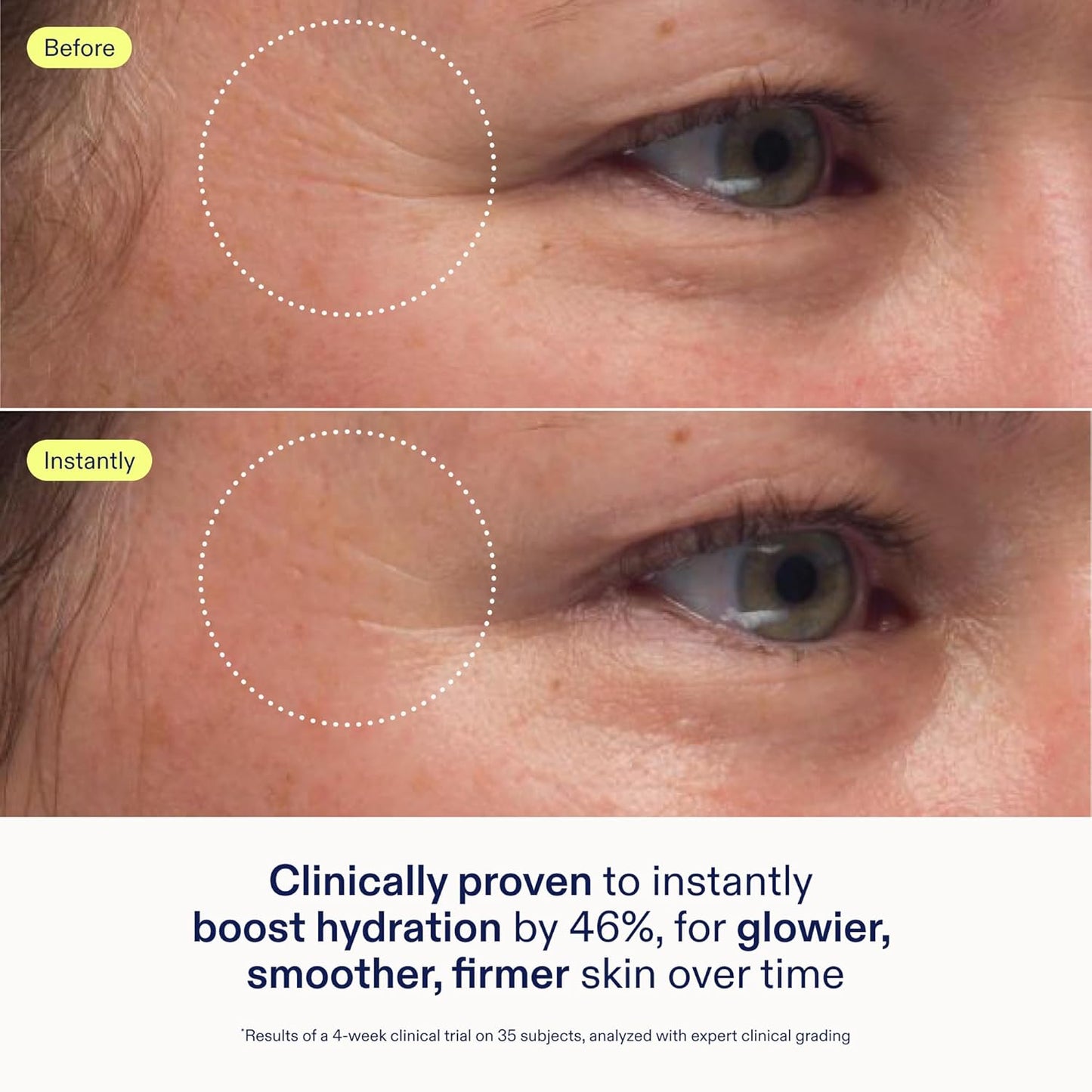 Skinfix Triple Lipid-Peptide Cream - 3.3 oz - Rich Face Moisturizer to Instantly Hydrate & Restore Dry, Sensitive Skin - Non-Comedogenic, Fragrance Free, Vegan, Cruelty Free