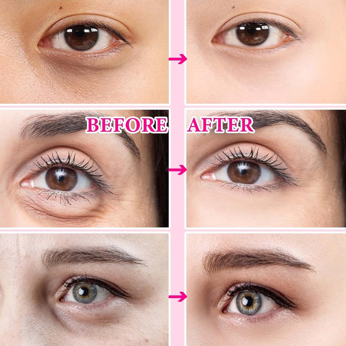 30 Pairs Eye Mask,Under Eye Patches For Dark Circles And Puffiness,Reduces Eye Bags and Smoothes Frownies,Improve Dry and Hydrated Skin Around Eyes,Eye Treatment Patches,Skin Care Products