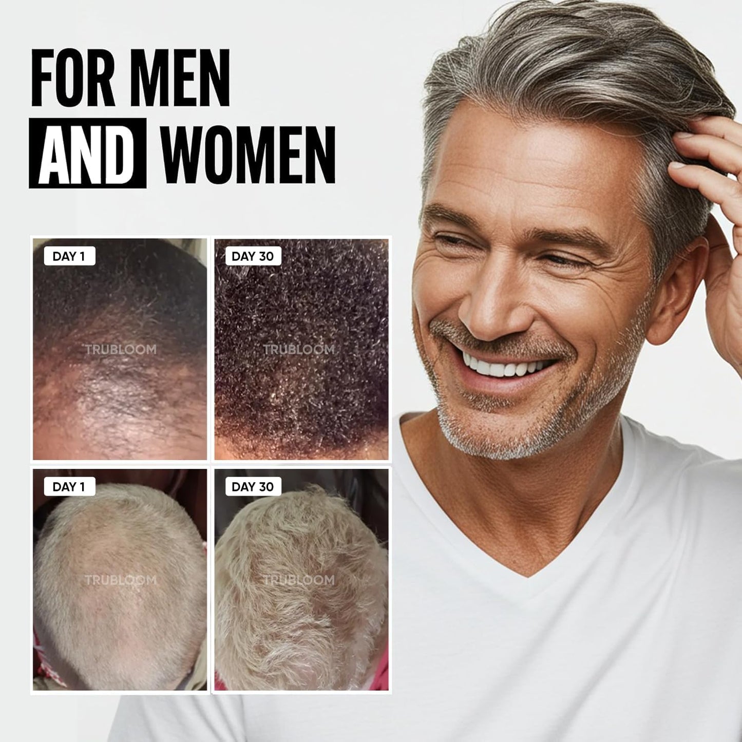 Tru Bloom Hair Growth Vitamins - 1 Month Supply. Clinically Proven to Grow Fuller, Thicker Hair. Natural & Drug-Free with Biotin, MSM, Zinc, D3 + Hair Superfoods. Non GMO