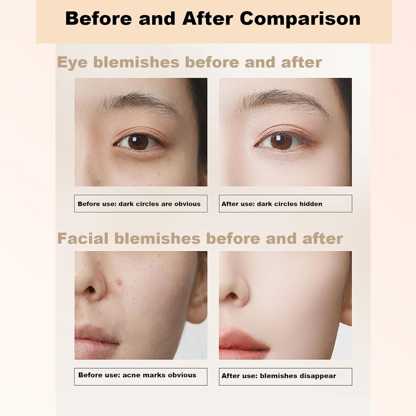 6 Colors Correcting Concealer Palette, 6 In 1 Contour Palette with 2 Packs Brush, Makeup Palette Contouring Foundation Color Corrector Palette, Color Corrector for Dark Circles, Blemish, Acne