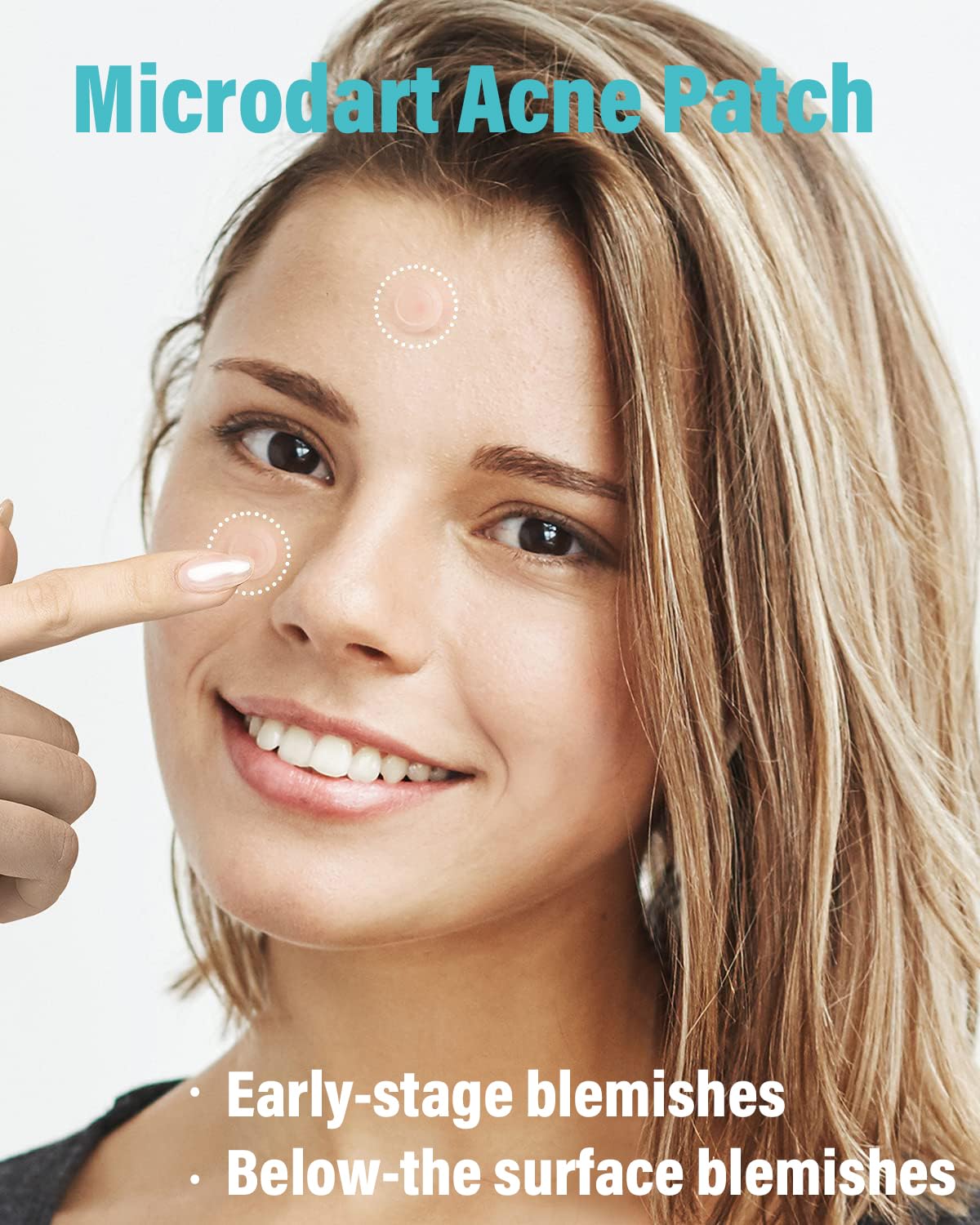 Microdart Acne Patch (72 Patches) - Hyaluronate, Salicylic Acid, Vitamin C, Microdart Pimple Patch for Deep, Early Stage and Hidden Pimples (72 Count (Pack of 1))