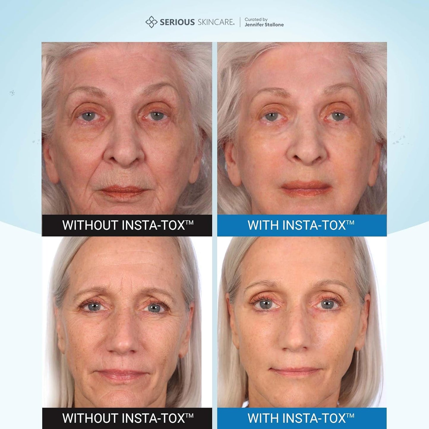 Serious Skincare INSTA-TOX Instant Wrinkle Smoothing Face Serum - Improves Appearance of Fine Lines - Temporary Skin Tightener - Line Filler .75 oz (1Pack)