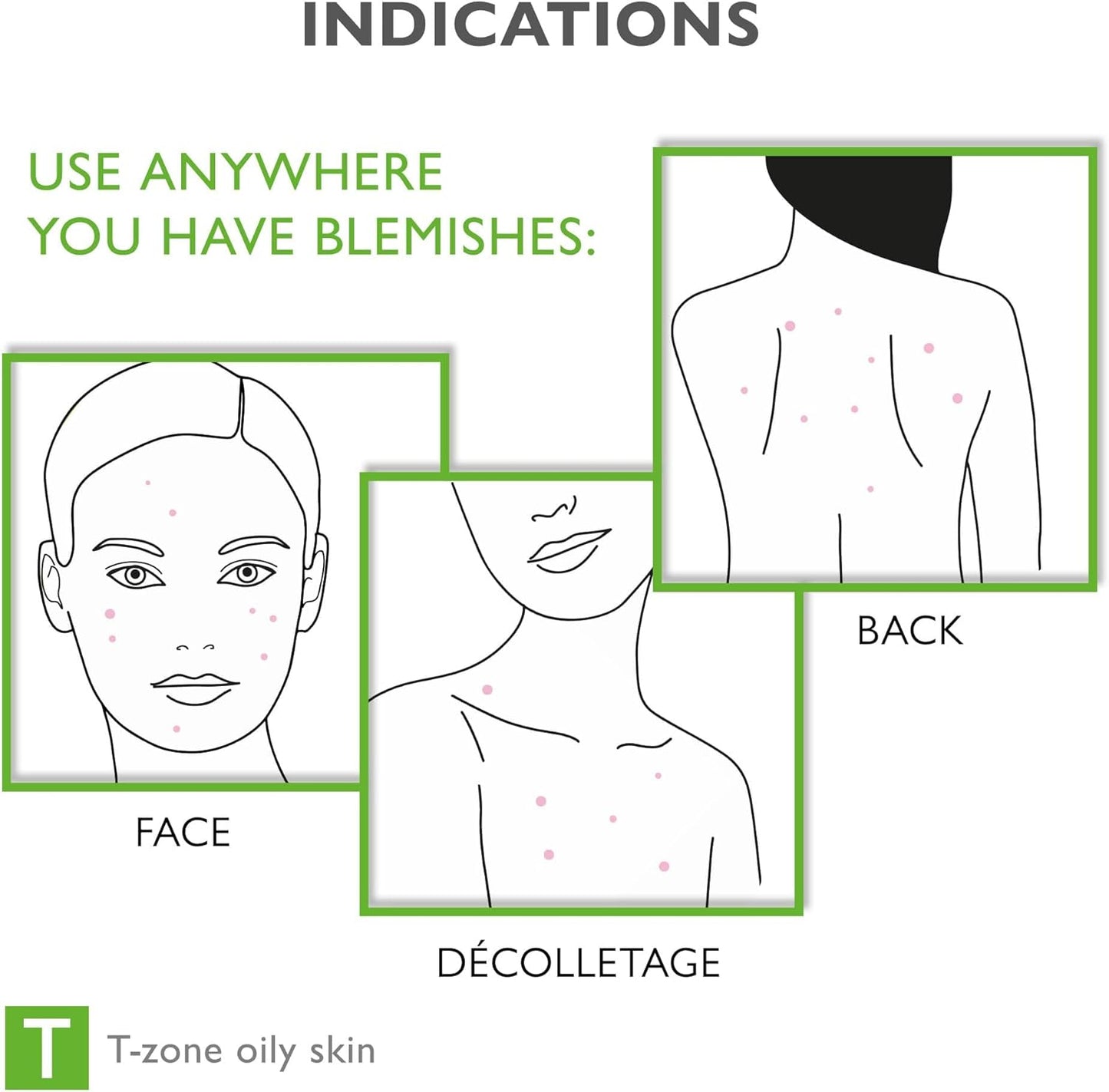 Face & Body Breakout Solution - 3% Mandelic Acid Helps Clarify Blemish & Acne Prone Skin, Face, Back & Chest Pimples Exfoliating & Clearing Treatment, SEBO-ALMOND-CLARIS, 6.42 fl oz