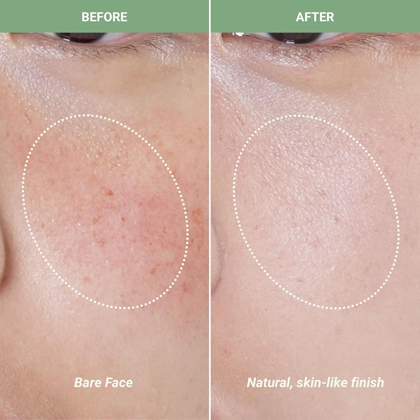 Meebak Cica Redness Solution Cream | Redness Relief for Face | Green Color-Corrector | BB Cream for Sensitive Skin | Green Color Corrector - Fair to Medium Skin