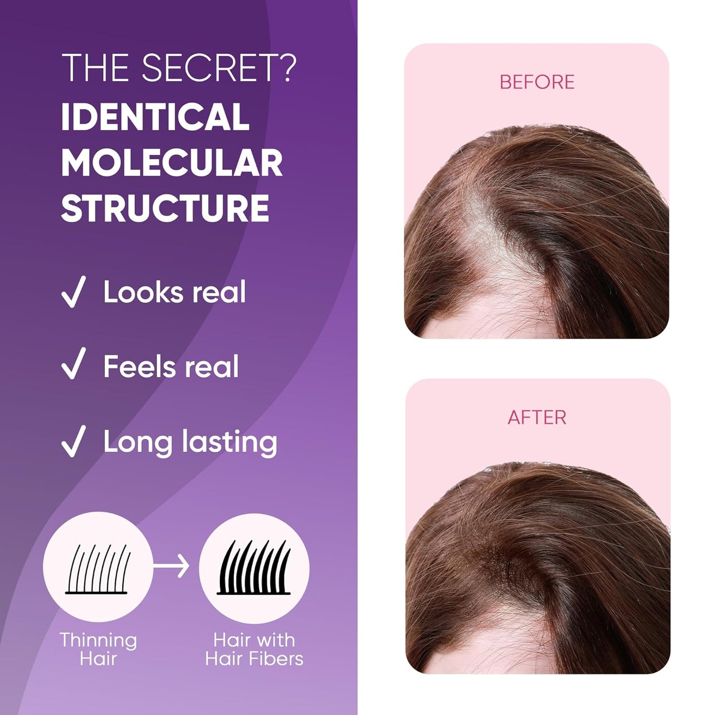 GBG Hair Fibers for Thinning Hair & Bald Spots (White) - 25g Bottle - Conceals Hair Loss - Instant Cover Up & Volume in 30 Seconds, Hair Powder for Women & Men - Cruelty Free