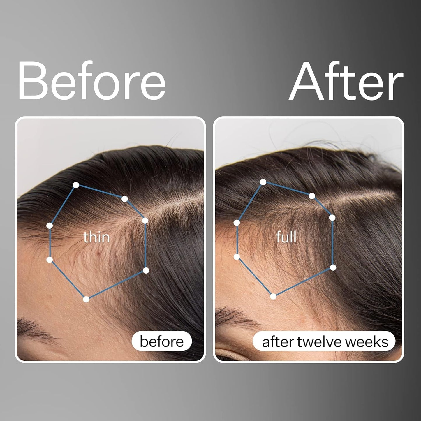 Act+Acre Cold Processed Stem Cell Scalp Serum - Promotes Thicker and Fuller-Looking Hair - Soothes and Hydrates the Scalp - Sulphate and Paraben Free - Aloe Vera for Improved Scalp Health - 1 fl oz.