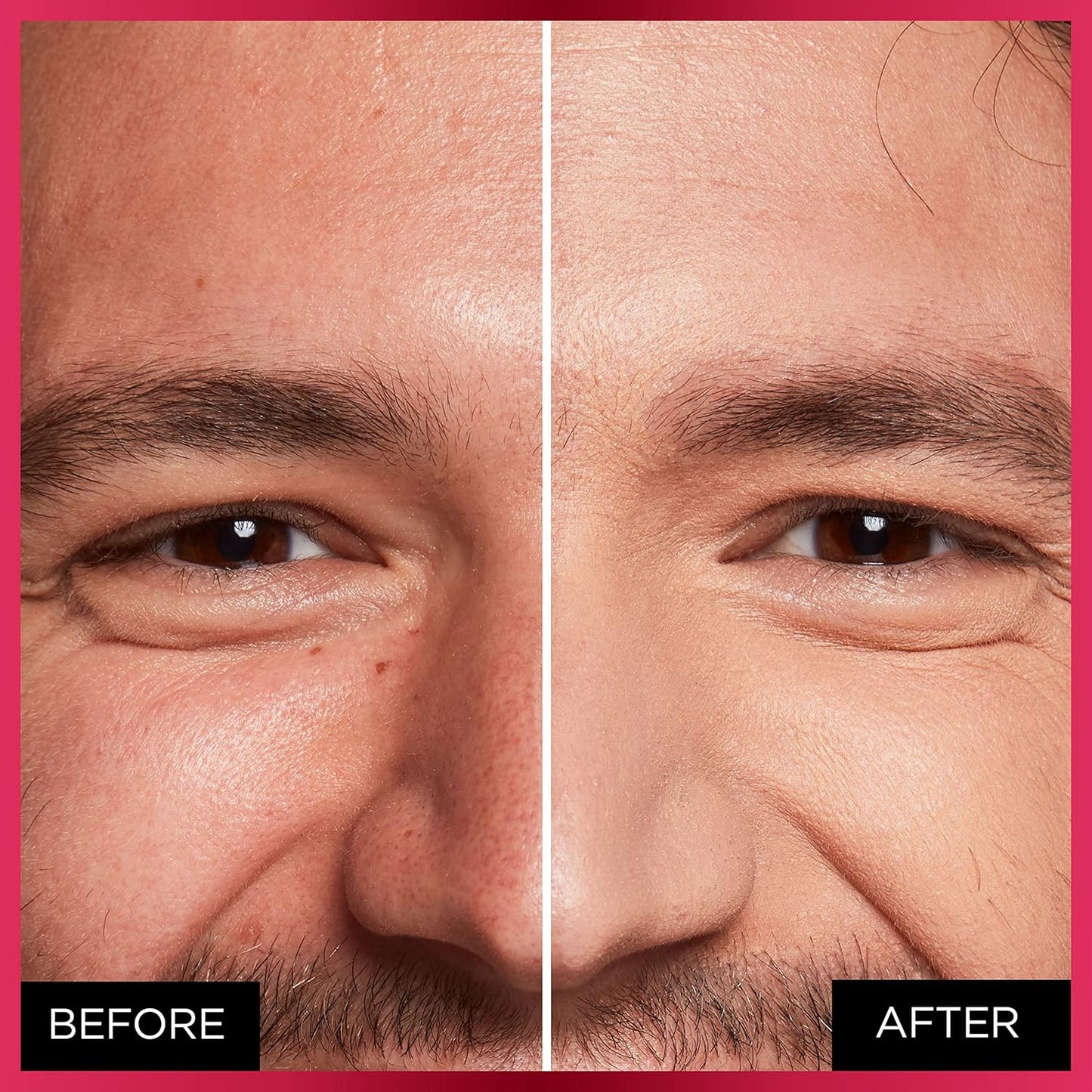 L'Oreal Paris Infallible More Than Concealer 11ml - 332 Amber